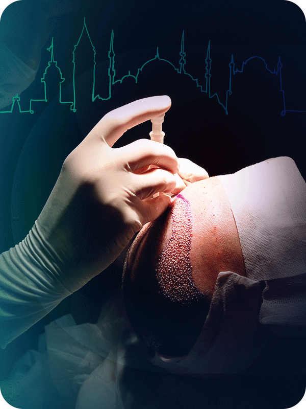 DHI-hair-transplant-3