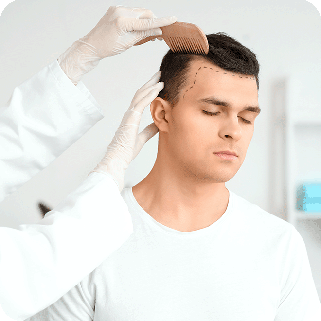 DHI-hair-transplant-5