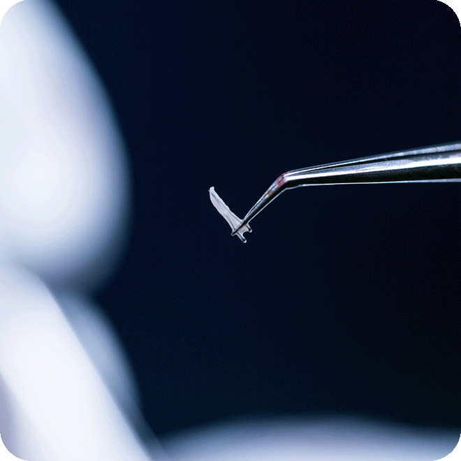 DHI-hair-transplant-7