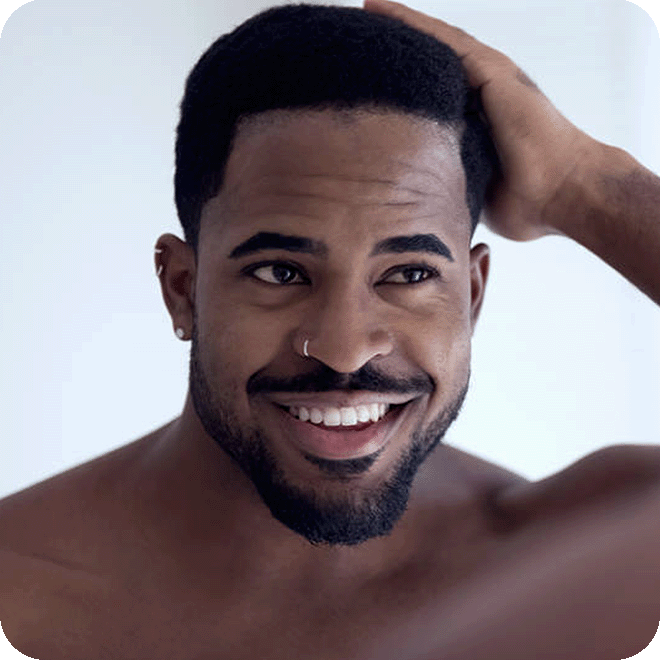 afro-hair-transplant-11