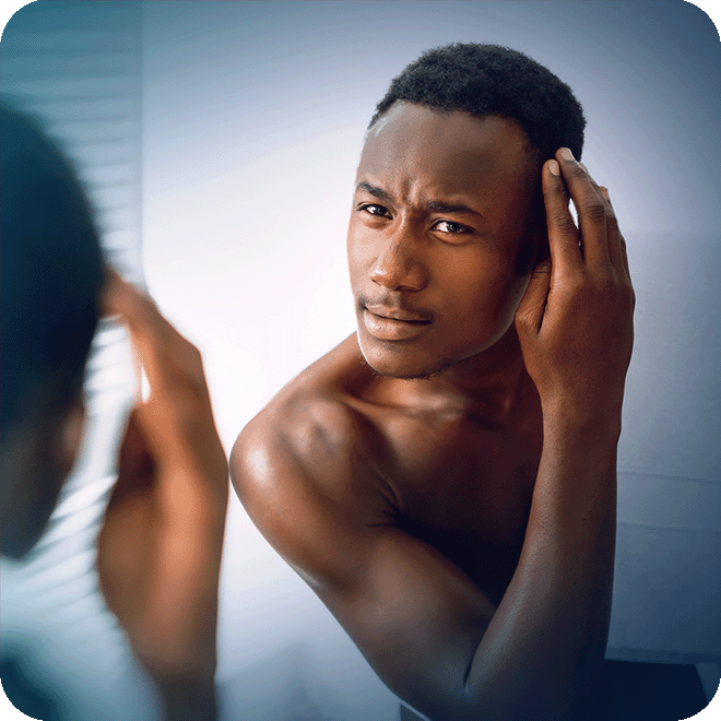 Afro Hair Transplant