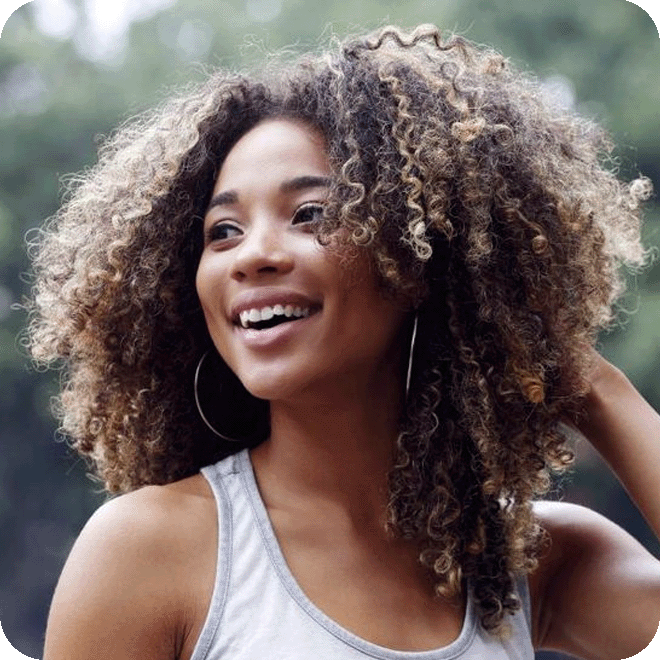 afro-hair-transplant-5