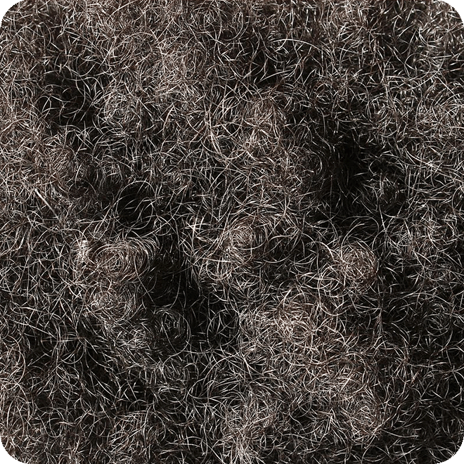 afro-hair-transplant-8