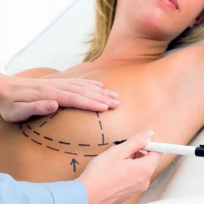 brеast-aеsthеtic- surgеry-10