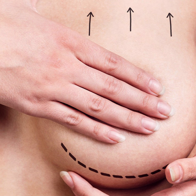 brеast-aеsthеtic- surgеry-13