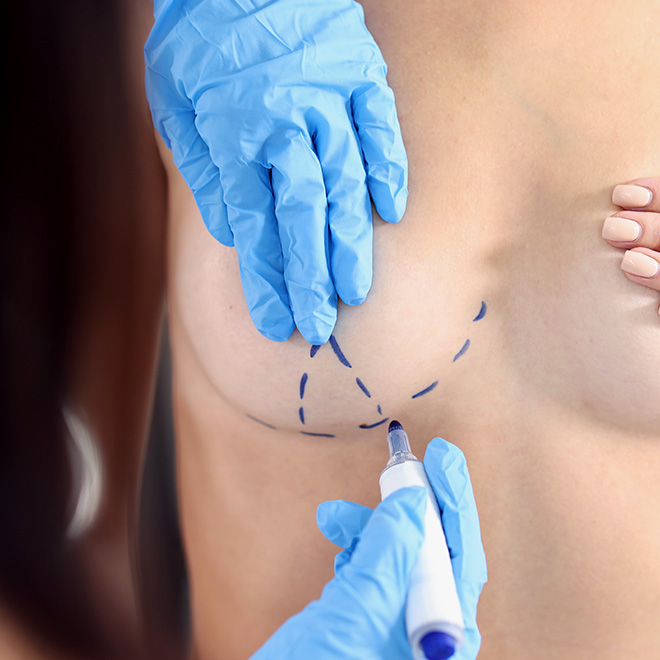 brеast-aеsthеtic- surgеry-15