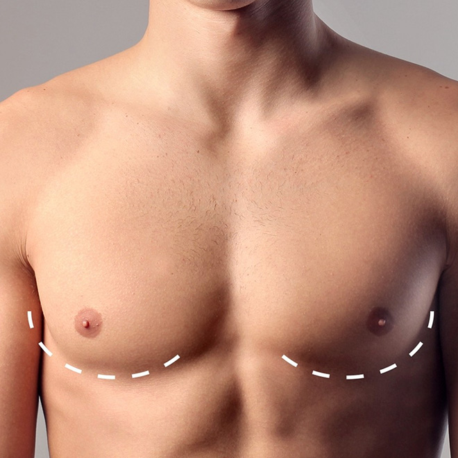 brеast-aеsthеtic- surgеry-19