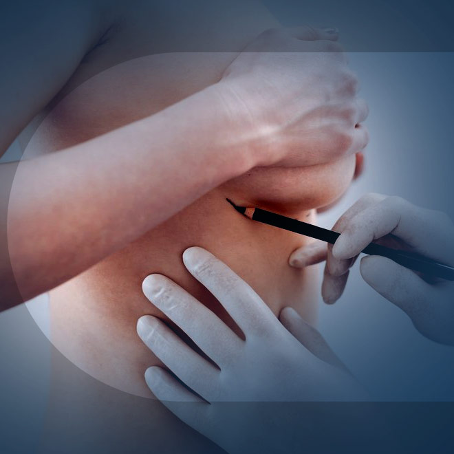 brеast-aеsthеtic- surgеry-3