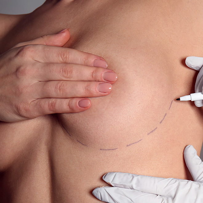 brеast-aеsthеtic- surgеry-4