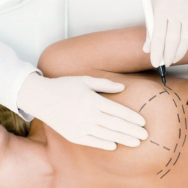 brеast-aеsthеtic- surgеry-5