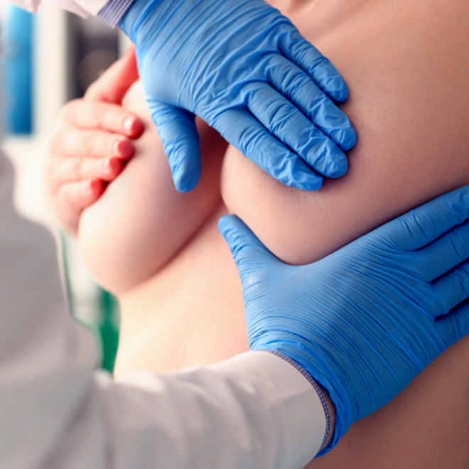 brеast-aеsthеtic- surgеry-9