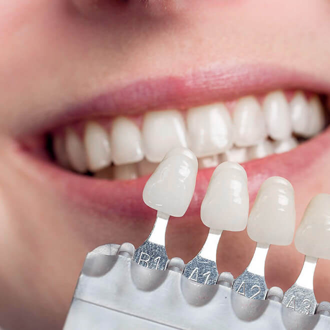 cosmetic-dentistry-12 (1)