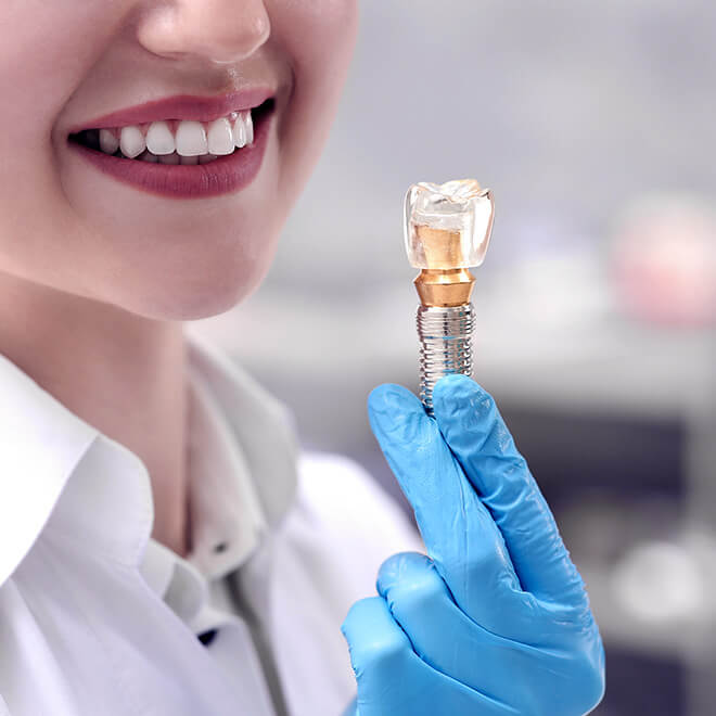 dental-implants-6