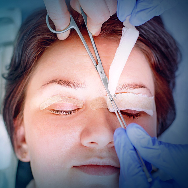 Eyelid Surgery