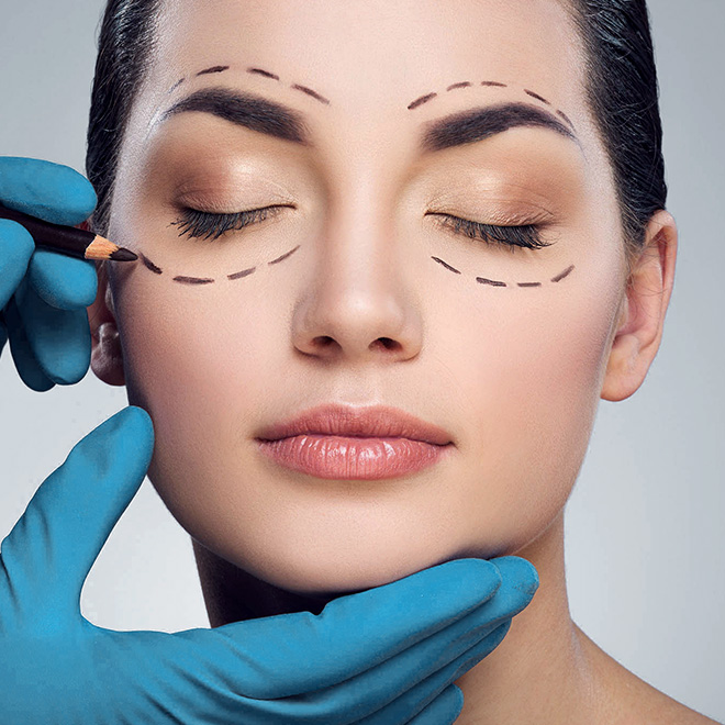 eyelid-surgery-8