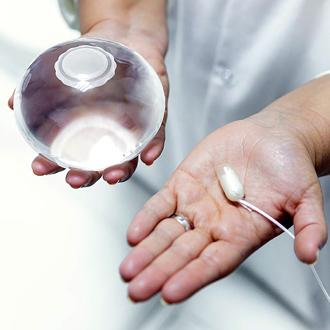 gastric-balloon-5