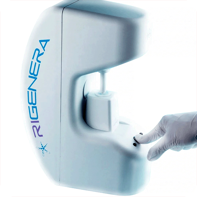 hair-loss-regenera-activa-10