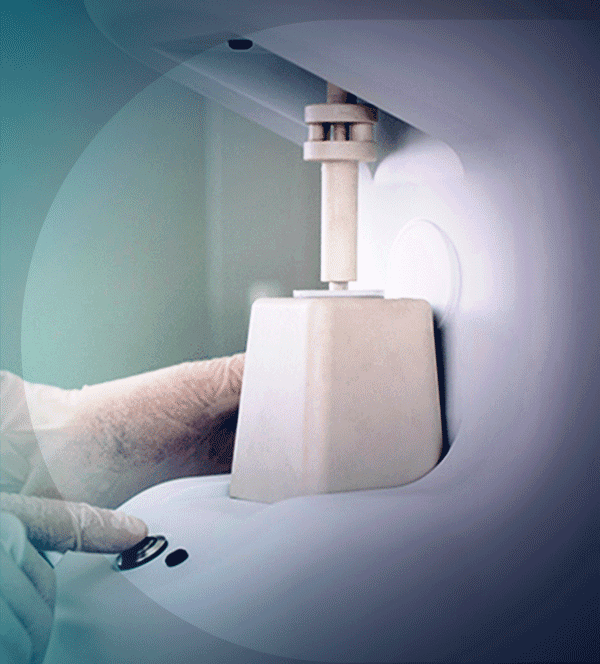 hair-loss-regenera-activa-2