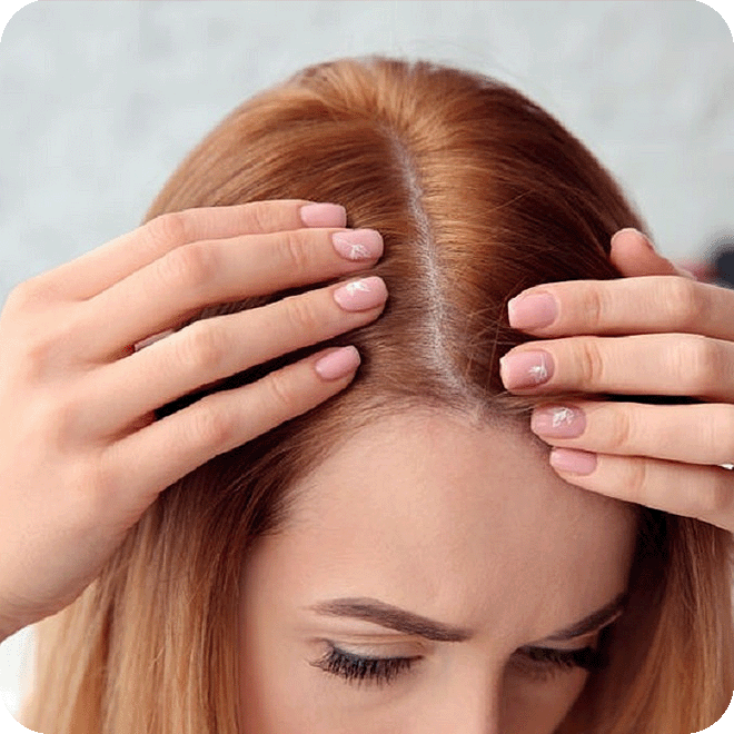 hair-transplant-for-women-7