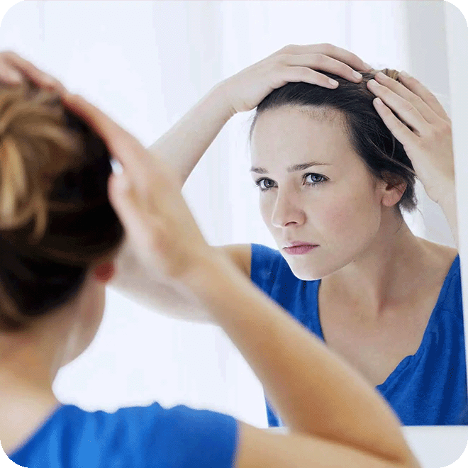 hair-transplant-for-women-8