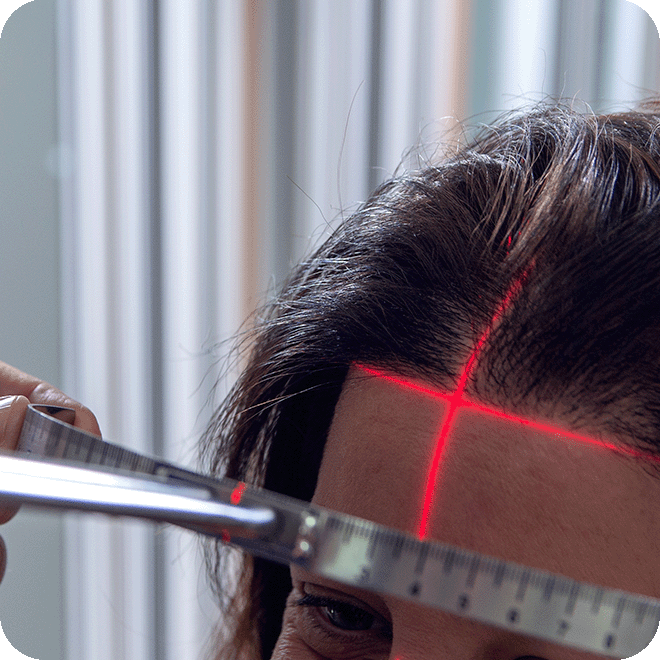 hair-transplant-for-women-9