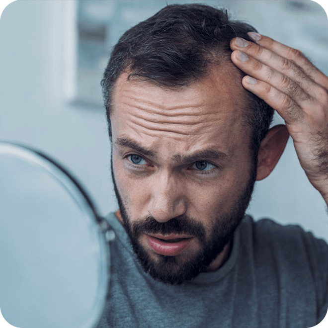 manuel-fue-hair-transplant-4