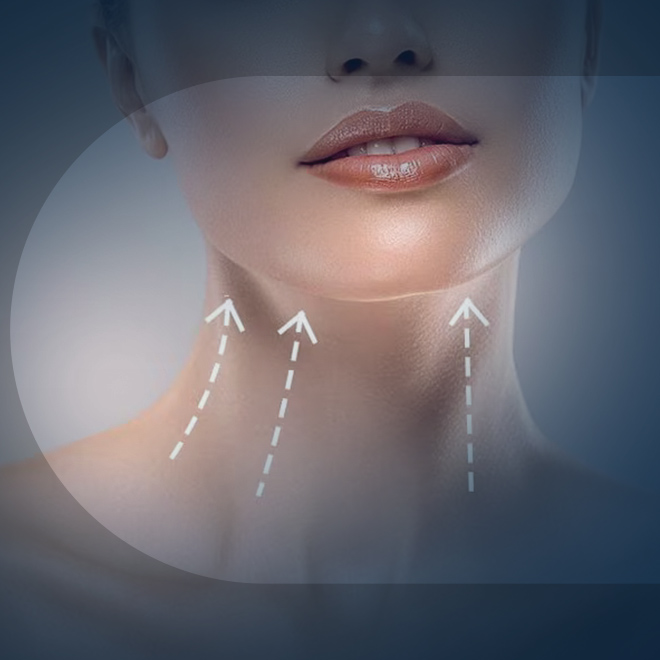 necklift-surgery-3