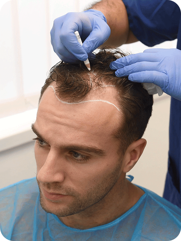 needle-free-hair-transplant-3