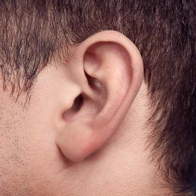 prominent-ear-6
