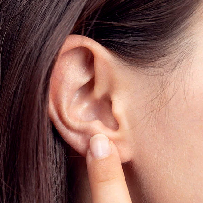 prominent-ear-9