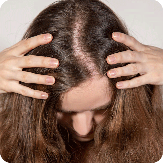 sapphire-fue-hair-transplant-9