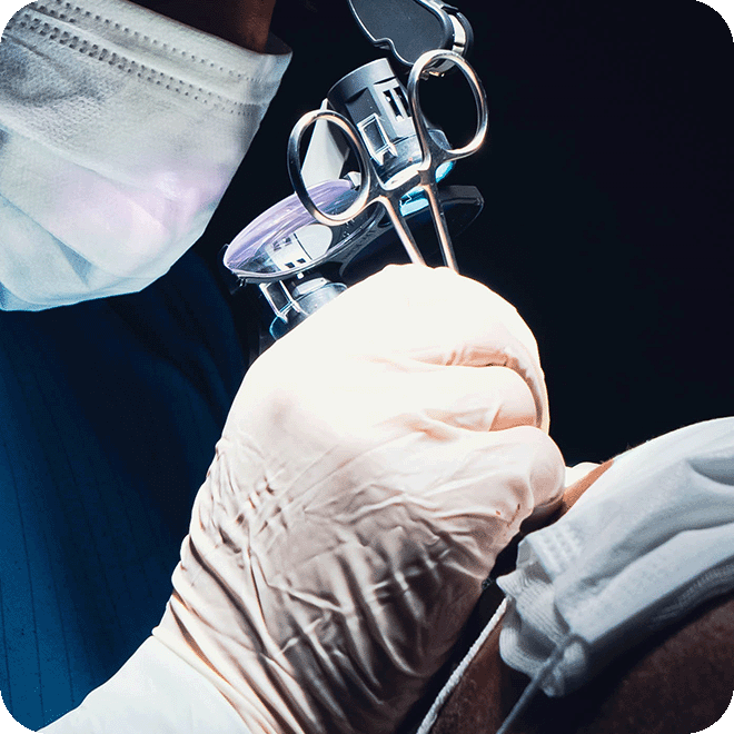 sedation-hair-transplant-10