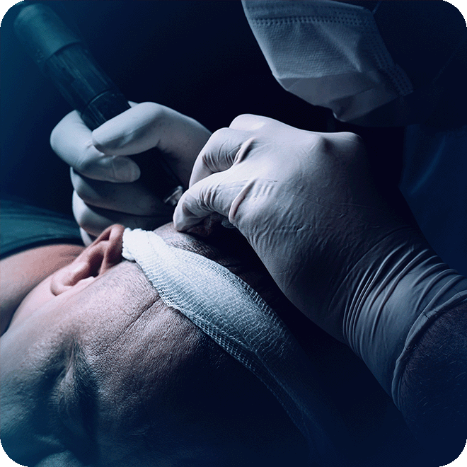 sedation-hair-transplant-2