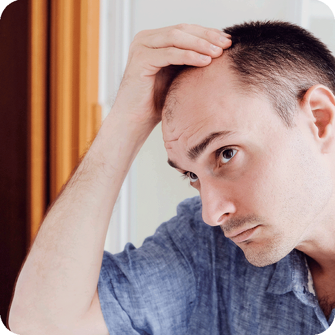 sedation-hair-transplan