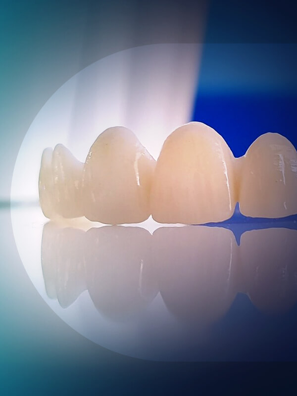 zirconium-veneers-3