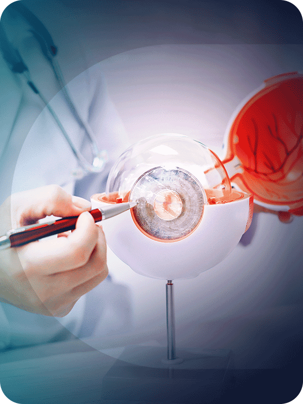 cataract-eye-surgery-3