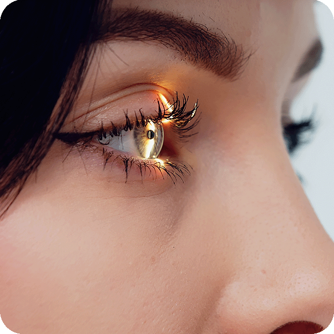 corneal-transplant-4