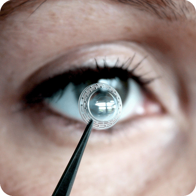 corneal-transplant-7