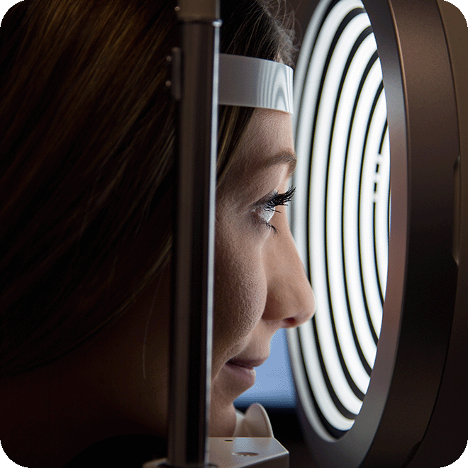 corneal-transplant-8